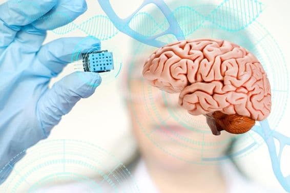 Implantación de chip en el cerebro humano.