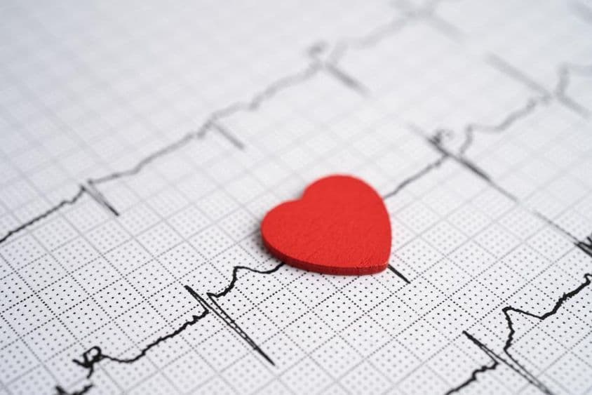 ECG con un corazón rojo.