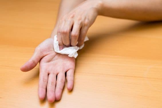 Mujer sufriendo de manos sudorosas.